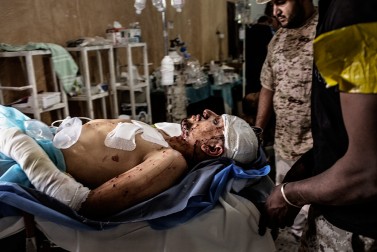 A fighter loyal to Libya's Government of National Accord lies on a stretcher in a hospital in the outskirts of Sirte after being wounded by an explosion while fighting against Islamic State (IS) on October 2, 2016.